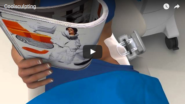 coolsculpting à Marseille - Dr JL Jauffret