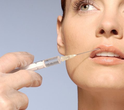 Injection d'acide hyaluronique à Marseille - DR Jauffret, chirurgie et médecine esthétique